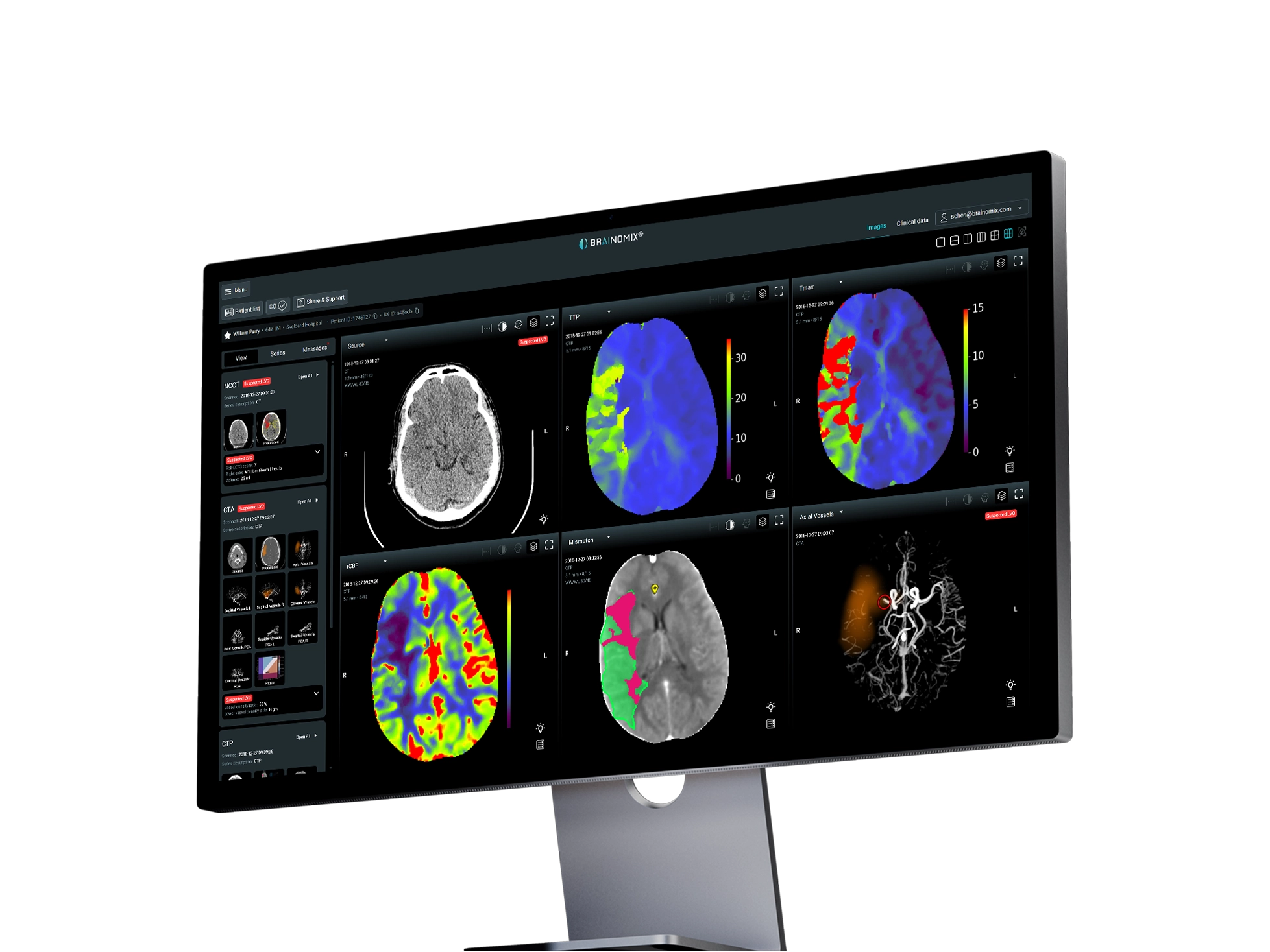 Brainomix 360 Stroke EU CE.webp