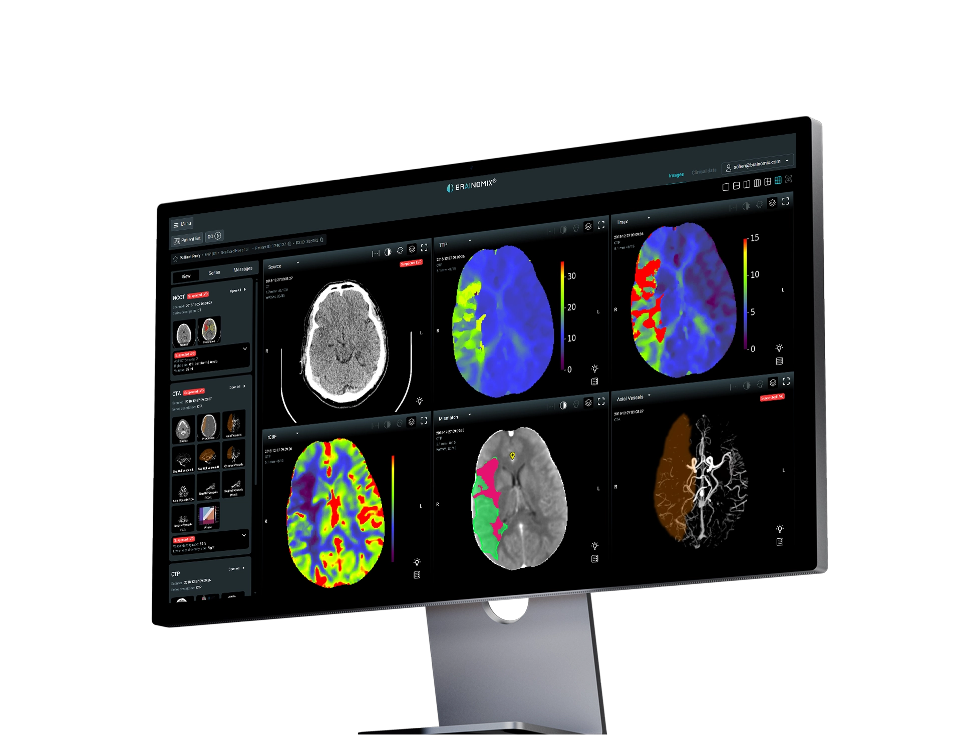 Brainomix 360 Stroke US FDA.webp